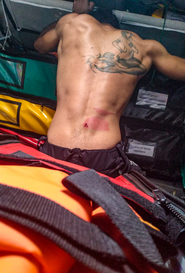 vendée globe blessure