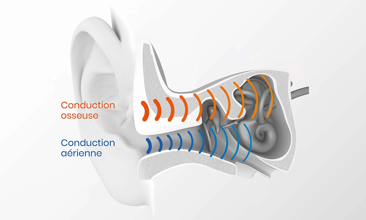 Conduction osseuse Shokz