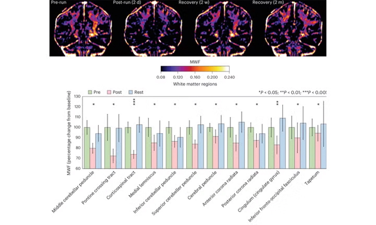 cerveau marathon