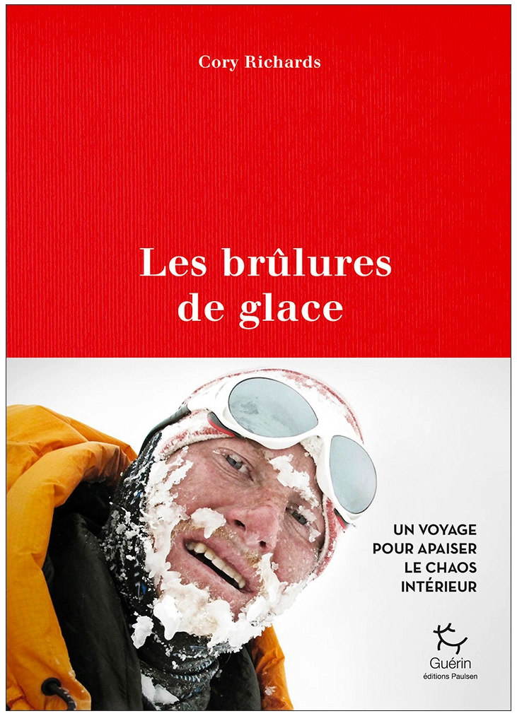 Les brulures de glaces